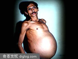 10 Most Bizarre People十大奇人