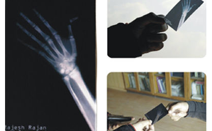 » 全球最独特的名片X-Ray visiting card 酷辣客