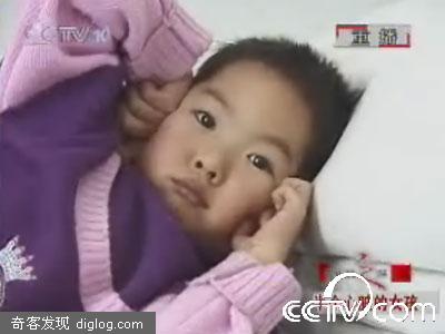 7岁女童竟只有半个心脏 全身泛紫