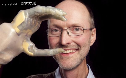 仿生手  Touch Bionics推出世界上首款仿生手指:ProDigits